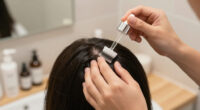 11 Best Hair Loss Treatments in 2026